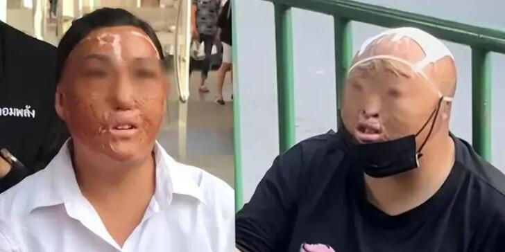 曼谷出現多名中國籍毀容乞討者